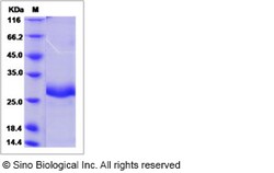 Sino Biological Recombinant Canine IGFBP1 Protein (His Tag), Quantity: