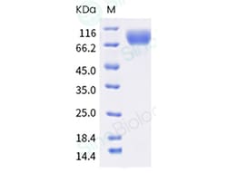 Sino Biological Protein Canine GUCY2C 100ug, Quantity: Each of 1