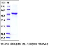 Sino Biological Rat GPT1 / GPT Protein (His Tag) 10ug, Quantity: Each of