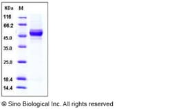 Sino Biological Recombinant Rat GPT2 Protein (His Tag), Quantity: Each
