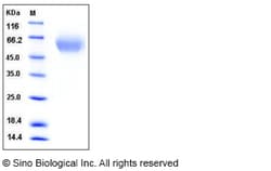 Sino Biological Recombinant Rat TIM-1/HAVCR1 Protein (His Tag), Quantity: