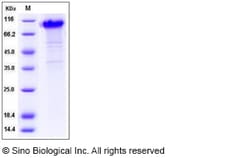 Sino Biological Rat KIM-1 / TIM1 / HACVR1 Protein (His & Fc Tag) 100ug,