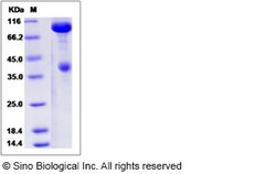 Sino Biological Recombinant Rat c-MET/HGFR Protein (hFc Tag), Quantity: