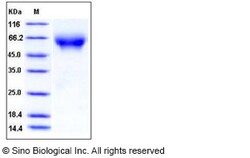 Sino Biological Recombinant Rat CD155/PVR Protein (His Tag), Quantity: