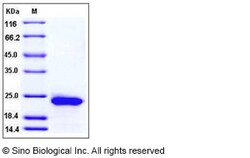Sino Biological Recombinant Rat RBP4 Protein (His Tag), Quantity: Each