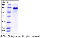 Sino Biological Recombinant Rat DLL1 Protein (His Tag), Quantity: Each