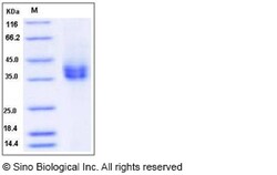 Sino Biological Recombinant Rat CD89/FCAR Protein (His Tag), Quantity: