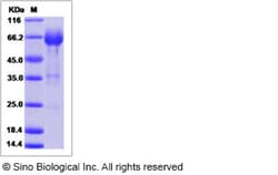 Sino Biological Rat CD32a / Fc gamma RIIA / FCGR2A Protein (ECD, Fc Tag)