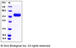Sino Biological Recombinant Rat CNTFR Protein (His Tag), Quantity: Each