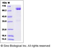 Sino Biological Rat GFRA1 / GFR alpha-1 Protein (Fc Tag) 100ug, Quantity: