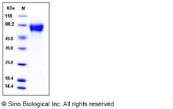 Sino Biological Recombinant Rat GFR Alpha-1/GFRA1 Protein (His Tag), Quantity: