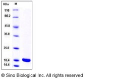 Sino Biological Recombinant Rat IL-1 beta Protein (mature form), Quantity: