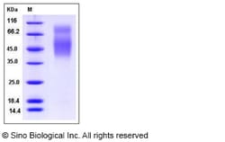 Sino Biological Recombinant Rat B7-2/CD86 Protein (His Tag), Quantity: