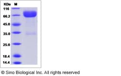 Sino Biological Recombinant Rat B7-1/CD80 Protein (ECD, hFc Tag), Quantity: