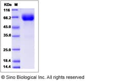 Sino Biological Recombinant Rat Growth Hormone Receptor Protein (hFc Tag),