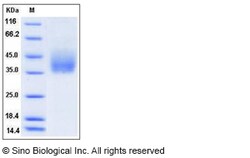 Sino Biological Recombinant Rat Growth Hormone Receptor Protein (His Tag),