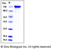 Sino Biological Recombinant Rat gp130/IL6ST Protein (His & mFc Tag), Quantity: