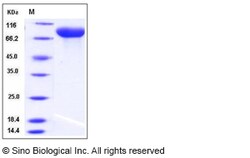 Sino Biological Recombinant Rat gp130/IL6ST Protein (His Tag), Quantity: