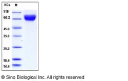 Sino Biological Rat E-Selectin / CD62e / SELE Protein (His Tag) 100ug,