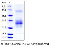 Sino Biological Recombinant Rat Fas/CD95/TNFRSF6 Protein (His Tag), Quantity: