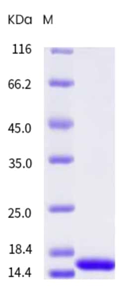 Sino Biological Recombinant Rat TNF-alpha Protein, Quantity: Each of 1