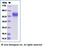 Sino Biological Recombinant Rat L-selectin/CD62L Protein (His Tag), Quantity: