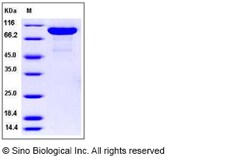 Sino Biological Rat MMP-9 / CLG4B Protein (His Tag) 50ug, Quantity: Each