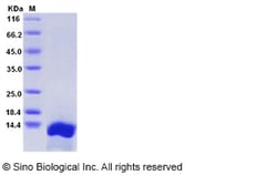 Sino Biological Rat CXCL10 / Crg-2 Protein (His Tag) 100ug, Quantity: Each