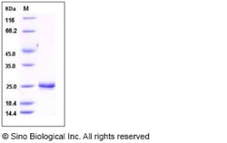 Sino Biological Recombinant Rat Lipocalin-2/NGAL Protein (His Tag), HPLC-verified,