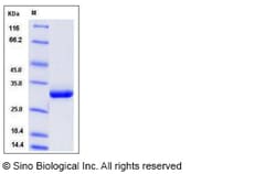 Sino Biological Recombinant Rat Serum Amyloid P Protein (His Tag), Quantity: