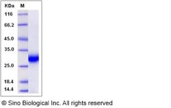 Sino Biological Recombinant Rat TIMP-1 Protein, HPLC-verified, Quantity: