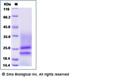 Sino Biological Rat PDGFA / PDGF-1 Protein (His Tag) 50ug, Quantity: Each