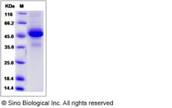 Sino Biological Recombinant Rat IL-1RA/IL-1RN Protein (hFc Tag), Quantity: