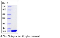 Sino Biological Recombinant Rat IL-2 Protein, Quantity: Each of 1