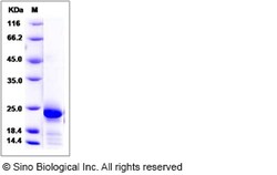 Sino Biological Recombinant Rat IL-6 Protein, Quantity: Each of 1