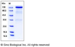 Sino Biological Recombinant Rat Her2/ERBB2 Protein (hFc Tag), Quantity: