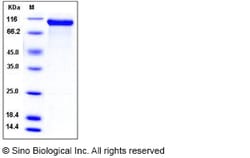 Sino Biological Recombinant Rat Her2/ERBB2 Protein (ECD, His Tag), HPLC-verified,