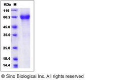 Sino Biological Recombinant Rat IL-7R alpha/CD127 Protein (mFc Tag), Quantity: