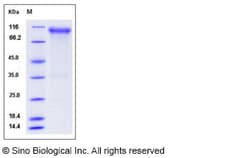 Sino Biological Recombinant Rat FGFR4 Protein (hFc Tag), Quantity: Each