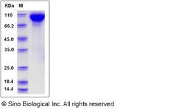 Sino Biological Recombinant Rat EGFR Protein (His Tag), HPLC-verified,