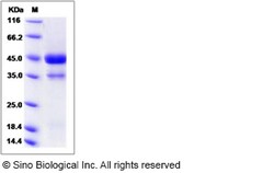 Sino Biological Mouse / Rat VEGFC / VEGF-C Protein (aa 108-223, Fc Tag)
