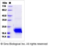 Sino Biological Mouse / Rat VEGFC / VEGF-C Protein (aa 108-223, His Tag),