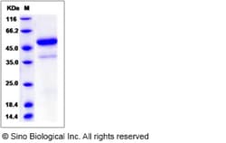 Sino Biological Rat VEGF-D / VEGFD / FIGF Protein (Fc Tag) 50ug, Quantity: