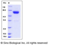 Sino Biological Recombinant Rat Ephrin B2 Protein (hFc Tag), Quantity: