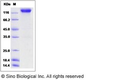 Sino Biological Recombinant Rat VEGFR2/KDR Protein (hFc Tag), Quantity: