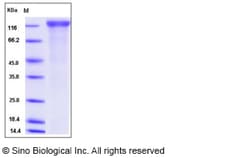 Sino Biological Rat VEGFR2 / Flk-1 / CD309 / KDR Protein (His Tag) 50ug,
