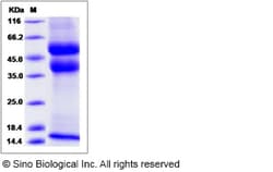 Sino Biological Recombinant Rat TGF beta 1 Protein (Latent, His Tag), Quantity: