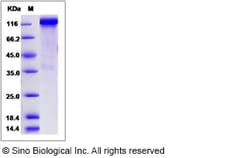 Sino Biological Recombinant Rat ERBB4/Her4 Protein (hFc Tag), Quantity:
