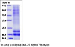 Sino Biological SARS-CoV-2 (2019-nCoV) Nucleocapsid(P13L)-His Recombinant