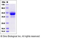 Sino Biological Recombinant Rat ALK4/ACVR1B Protein (hFc Tag), Quantity: